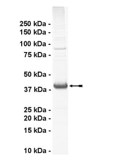 Eurofins DiscoverX ALK2 Protein, Active 10 &mu;g | Buy Online | Eurofins DiscoverX | Fisher Scientific